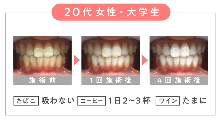 ＼ ２０代 女性・大学生 ／【 たばこ 】吸わない 【 コーヒー 】１日２～３杯 【 ワイン 】たまに